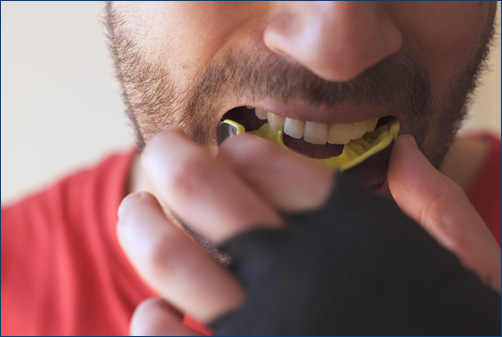 Mouthguards